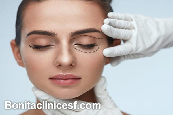 دکتر خوب برای افتادگی پلک در اصفهان | کلینیک بنیتا اصفهان