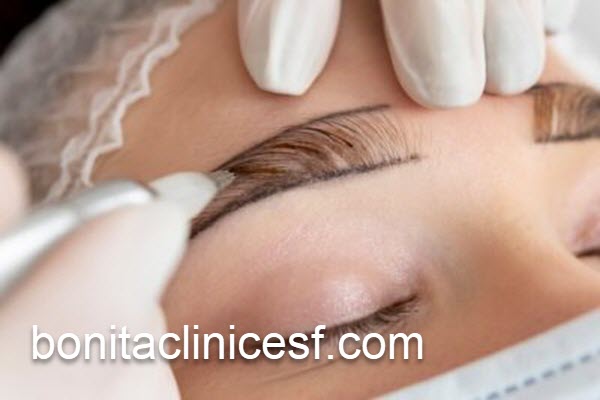 کاشت ابرو دائمی با بهترین قیمت | کلینیک بنیتا اصفهان
