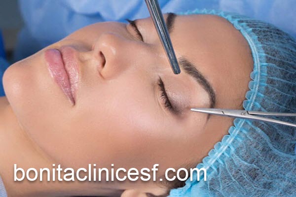 قیمت بلفاروپلاستی پلک در اصفهان | کلینیک بنیتا اصفهان