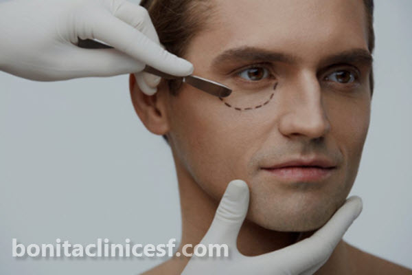 هزینه بلفاروپلاستی چقدر است؟