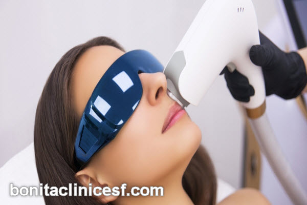 آیا لیزر موهای زائد دائمی است؟ | کلینیک بنیتا اصفهان