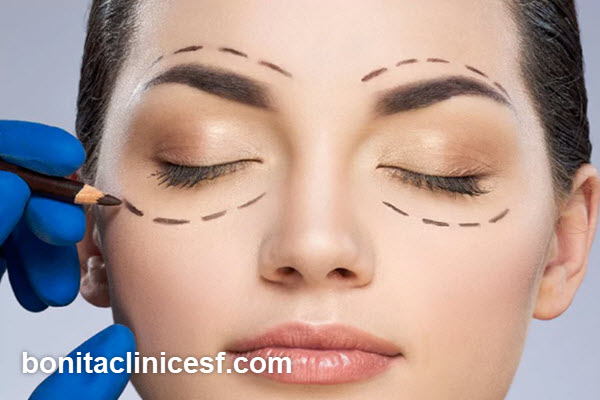 مراقبت های بعد از بلفاروپلاستی کدام است؟ | کلینیک بنیتا اصفهان