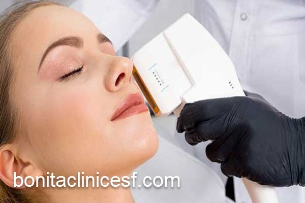 ماندگاری هایفوتراپی صورت چقدر است؟ | کلینیک بنیتا اصفهان