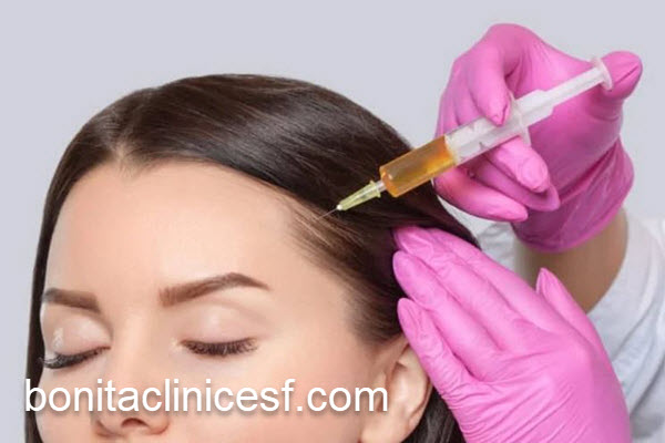 پی آر پی مو در بهترین کلینیک زیبایی اصفهان | کلینیک بنیتا اصفهان