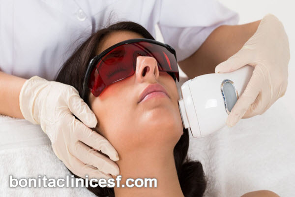 با چند جلسه لیزر موهای زائد از بین می رود؟ | کلینیک بنیتا اصفهان