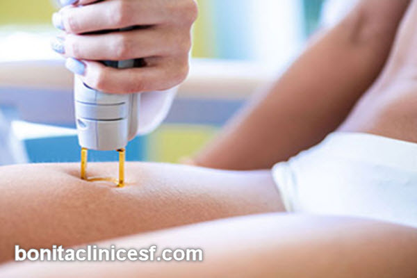 مراقبت های بعد از لیزر بیکینی | کلینیک بنیتا اصفهان