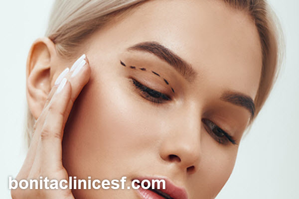 چه افرادی کاندیدای مناسب برای جراحی بلفاروپلاستی هستند؟ | کلینیک بنیتا اصفهان