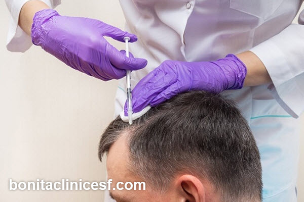 زمان مناسب کاشت مو چه زمانی است؟ | کلینیک بنیتا اصفهان