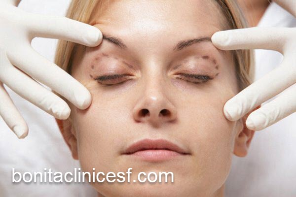 آشنایی با جدیدترین روش جراحی پلک | کلینیک بنیتا اصفهان