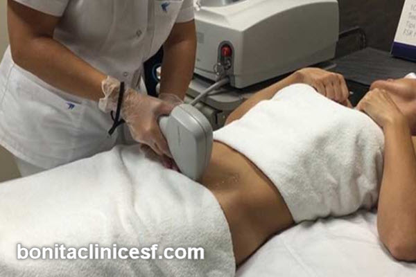 مرکز لیزر موهای زائد بدن | کلینیک بنیتا اصفهان
