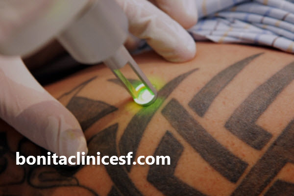 لیزر کیوسوئیچ چیست؟