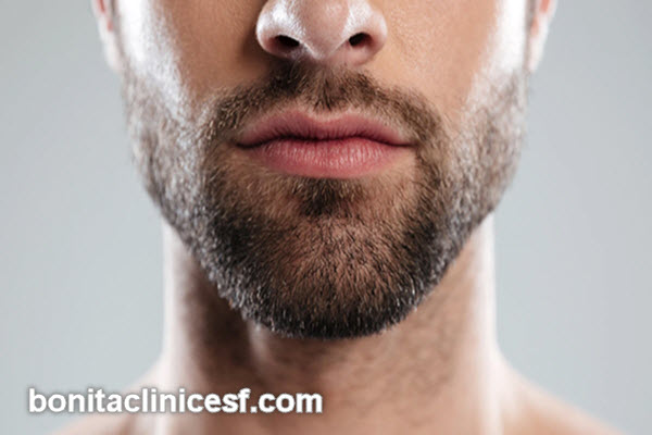 خصوصیات بهترین مرکز کاشت ریش در اصفهان | کلینیک بنیتا اصفهان