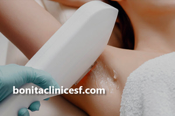 لیزر موهای زائد چیست؟