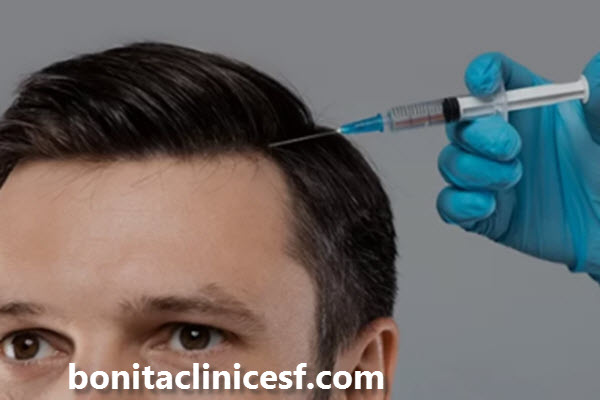 مراقبت های لازم بعد از پی آر پی مو