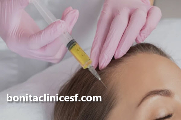 مزایای پی آر پی مو چیست؟