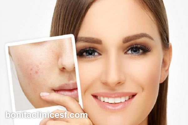 ویژگی های بهترین دکتر برای درمان اسکار در اصفهان | کلینیک بنیتا