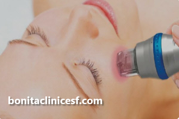 لیزر RF فرکشنال چیست؟ | اصفهان