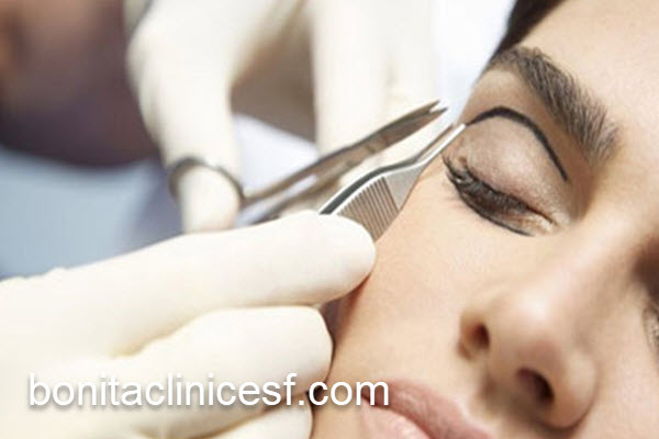 ماندگاری نتایج عمل بلفاروپلاستی | کلینیک بنیتا اصفهان