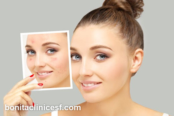 بهترین دکتر برای درمان اسکار در اصفهان | کلینیک بنیتا