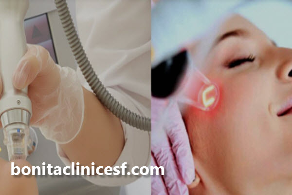 تفاوت RF فرکشنال با لیزر CO2 فرکشنال