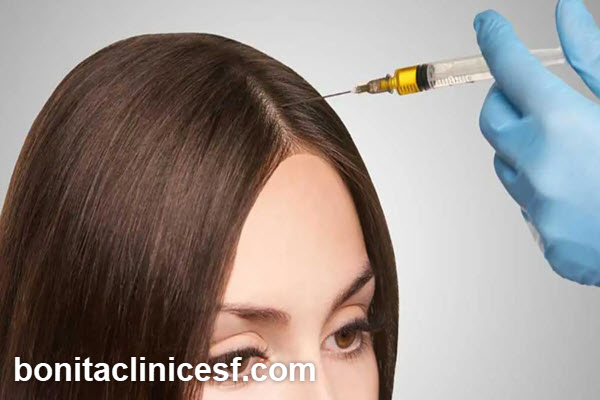 عوامل تأثیرگذار بر هزینه پی آر پی مو PRP | کلینیک بنیتا اصفهان