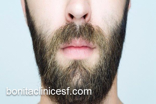 کاشت ریش در سن مناسب | کلینیک بنیتا اصفهان