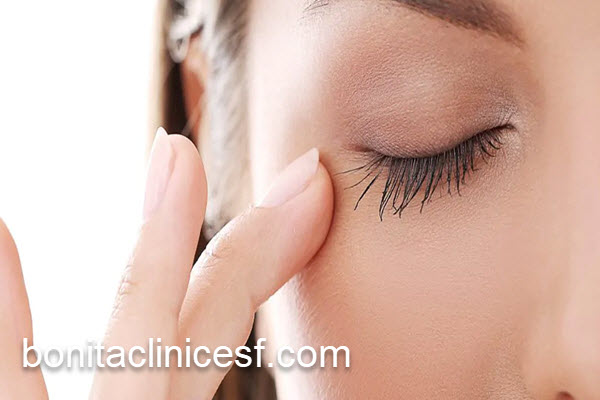 عوامل مؤثر در قیمت جراحی پلک بالا | کلینیک بنیتا اصفهان