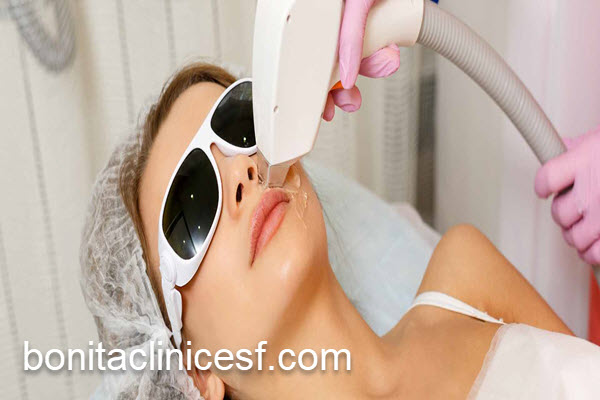 درمان مشکلات پوستی با لیزر CO2 فرکشنال | کلینیک بنیتا اصفهان