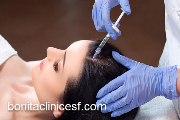 قیمت کاشت مو برای زنان | کلینیک بنیتا اصفهان