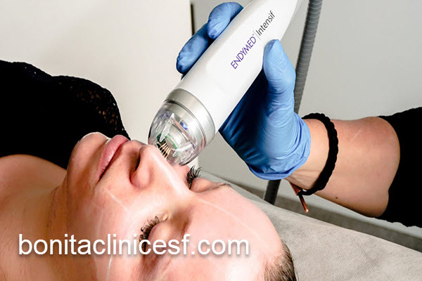 کاربردهای لیزر CO2 فرکشنال برای صورت | کلینیک بنیتا اصفهان