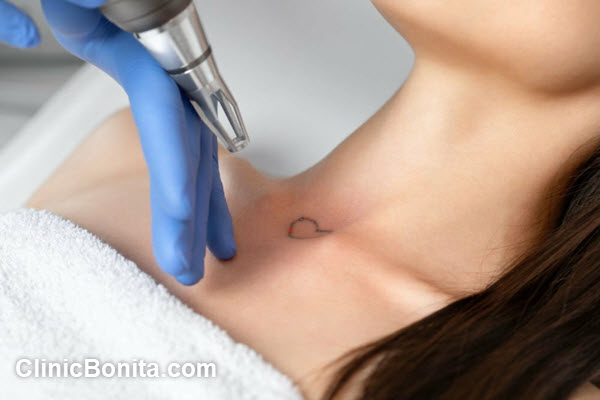 لیزر کیوسوئیچ چیست؟ و چه کاربردی دارد؟