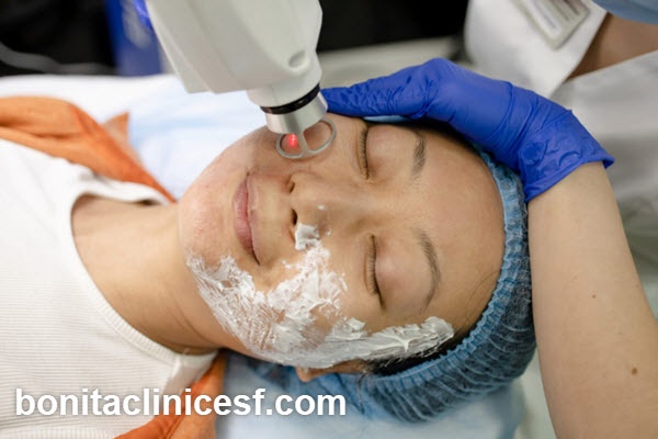 مراقبت های بعد از لیزر جای جوش | کلینیک بنیتا اصفهان