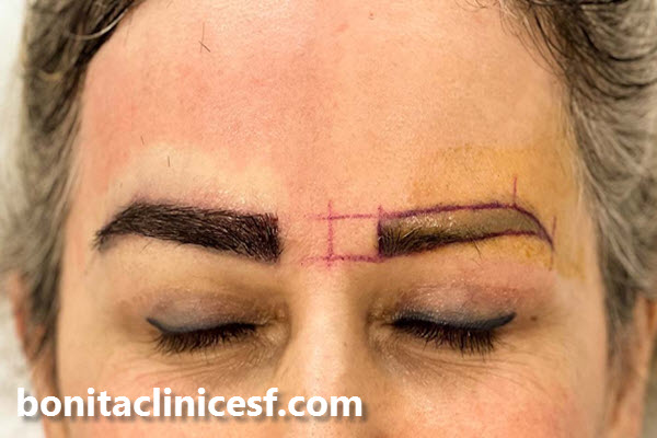 هزینه کاشت ابرو چقدر است؟