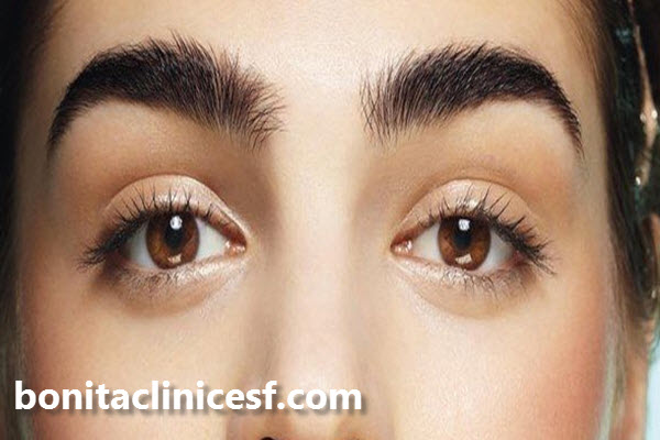 کاشت ابروی طبیعی چیست؟ | کلینیک بنیتا