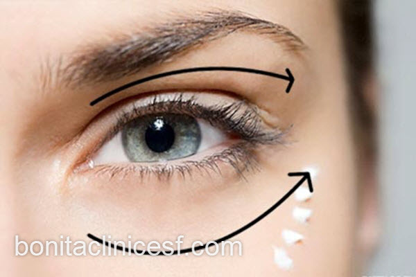 آشنایی با بهترین روش های درمان افتادگی پلک | کلینیک بنیتا اصفهان