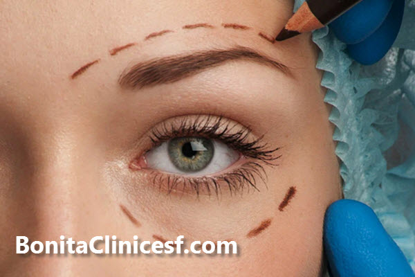 تغذیه مناسب بعد از بلفاورپلاستی