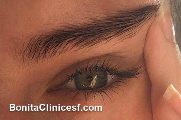 کاشت ابرو طبیعی و نچرال در اصفهان