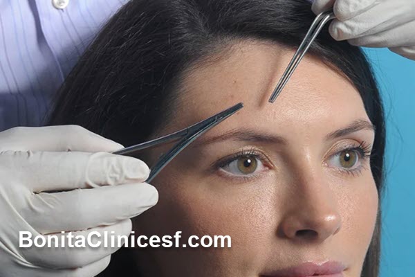 قیمت لیفت ابرو با نخ