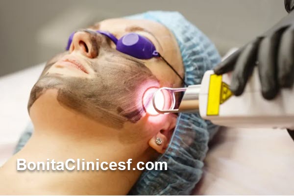 لیزر CO2 فرکشنال چیست؟