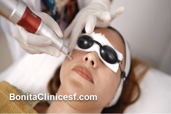 مراقبت های لازم بعد از لیزر co2 فرکشنال