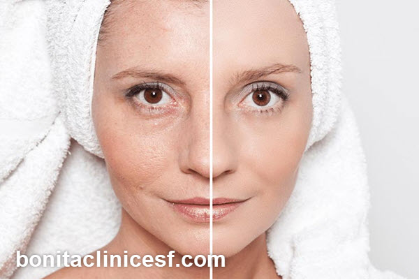 آر اف (RF) صورت چیست و چگونه کار می کند؟