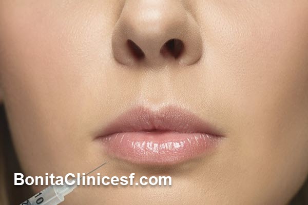 کاربردهای تزریق فیلر چیست؟