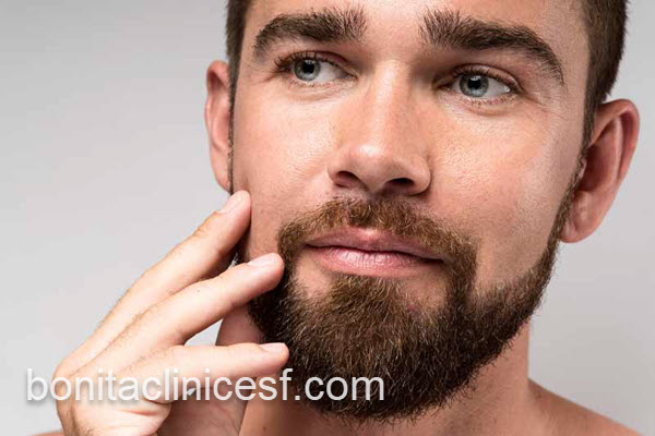 کاشت ریش و سبیل با روش جدید | کلینیک بنیتا اصفهان