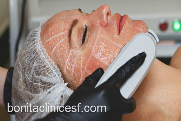 هایفوتراپی صورت با ماندگاری بالا | کلینیک بنیتا اصفهان