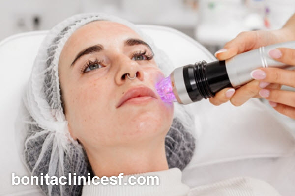 هزینه آر اف صورت چقدر است؟