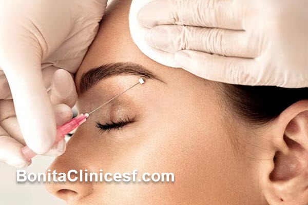 هزینه لیفت ابرو با نخ چقدر است؟