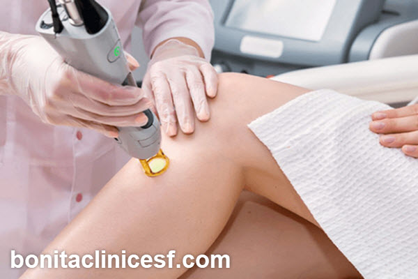 مزایای انتخاب مرکز معتبر برای لیزر