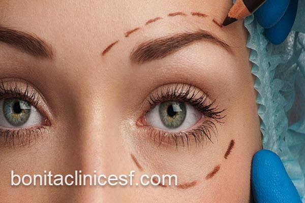 بلفاروپلاستی پلک با قیمت مناسب | کلینیک بنیتا اصفهان