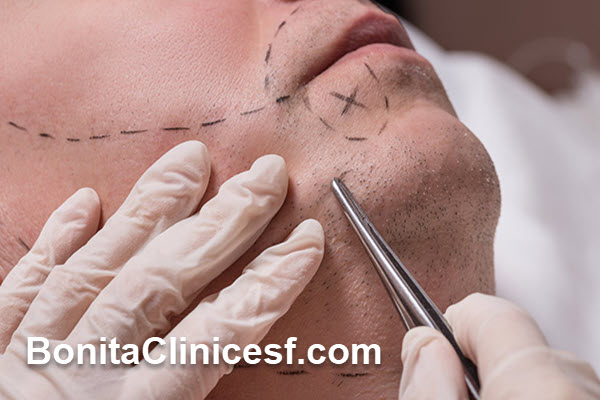 اهمیت کاشت ریش و سبیل در زیبایی چهره آقایان