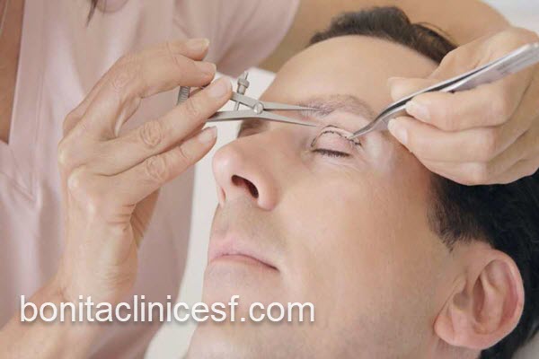 عمل بلفاروپلاستی پلک در کلینیک معتبر | کلینیک بنیتا اصفهان